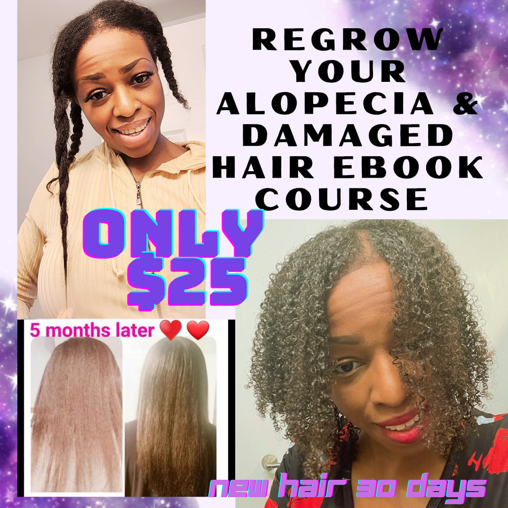Regrow Your Alopecia Back .. New Hair in 30 days