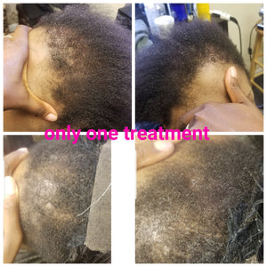 Instant Hair Re Growth Bundle