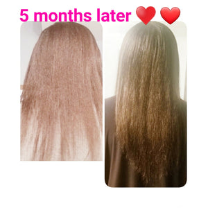 Instant Hair Re Growth Bundle