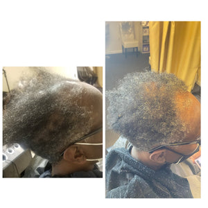 WD Instant Alopecia Growth Pak  (OIl Set)